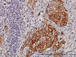 Anti-EIF4G3 Mouse Monoclonal Antibody [clone: 1D7]