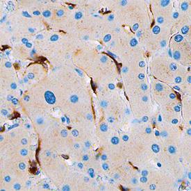 Anti-Stabilin-1 Mouse Monoclonal Antibody [clone: 840449]