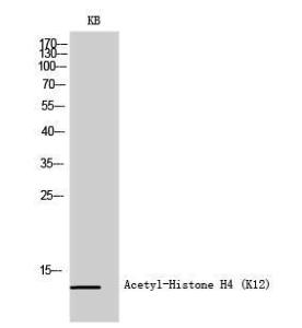 Antibody anti-histone H4 acetyl LYS12