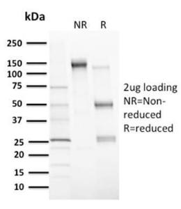 SDS-PAGE analysis of Anti-MDM2 Antibody [MDM2/2414] under non-reduced and reduced conditions; showing intact IgG and intact heavy and light chains, respectively. SDS-PAGE analysis confirms the integrity and purity of the antibody.