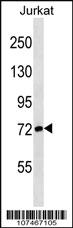 Anti-ATG7 Rabbit Polyclonal Antibody