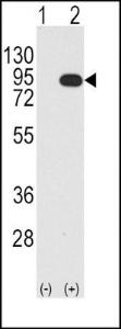 Anti-BRAF Rabbit Polyclonal Antibody (PE (Phycoerythrin))