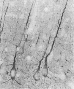 Immunohistochemistry analysis of rat neocortex. The Primary Antibody used was Anti-PSD95 Antibody [7E3] (A304702) at 1:1000