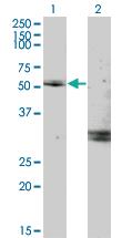 Anti-MYOC Mouse Monoclonal Antibody [clone: 2B4]