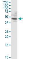 Anti-CTSD Rabbit Polyclonal Antibody