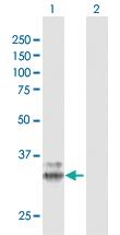 Anti-PPT1 Rabbit Polyclonal Antibody