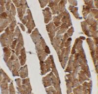 Anti-TGM5 Rabbit Polyclonal Antibody