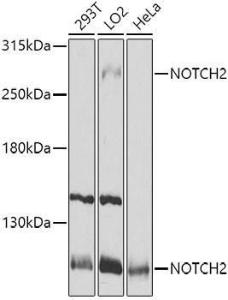 Western blot analysis of extracts of various cell lines, using Anti-Notch2 Antibody (A11168) at 1:1000 dilution