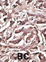 Anti-ATG7 Rabbit Polyclonal Antibody