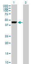 Anti-CTSD Rabbit Polyclonal Antibody