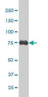 Anti-MED17 Mouse Monoclonal Antibody [clone: 1B5]