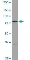 Anti-TGM4 Mouse Polyclonal Antibody