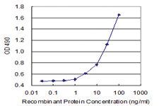 Anti-PPP6C Polyclonal Antibody Pair