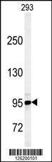 Anti-KDM7A Rabbit Polyclonal Antibody (AP (Alkaline Phosphatase))