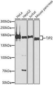 Western blot analysis of extracts of various cell lines, using Anti-TJP2/ZO2 Antibody (A11173) at 1:1,000 dilution