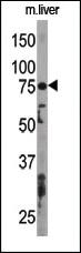 Anti-ATG7 Rabbit Polyclonal Antibody