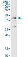 Anti-CTSD Rabbit Polyclonal Antibody