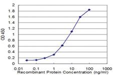 Anti-MYOC Mouse Monoclonal Antibody [clone: 2B4]