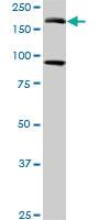 Anti-EIF4G3 Mouse Monoclonal Antibody [clone: 1H5]