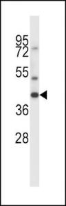 Anti-MAS1 Rabbit Polyclonal Antibody (FITC (Fluorescein Isothiocyanate))