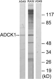 Western blot analysis of lysates from A549 and RAW264.7 cells using Anti-ADCK1 Antibody. The right hand lane represents a negative control, where the antibody is blocked by the immunising peptide.