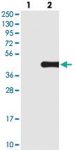 Anti-TRNAU1AP Rabbit Polyclonal Antibody