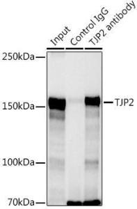 Immunoprecipitation analysis of 300 µg extracts of HeLa cells using 3 µg of Anti-TJP2/ZO2 Antibody (A11173). This Western blot was performed on the immunoprecipitate using Anti-TJP2/ZO2 Antibody (A11173) at a dilution of 1:1000