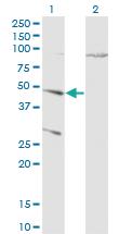 Anti-CTSD Mouse Monoclonal Antibody [clone: 3F12-1B9]