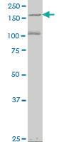 Anti-EIF4G3 Mouse Monoclonal Antibody [clone: 1H5]