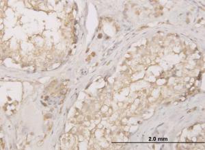 Anti-CTSD Mouse Monoclonal Antibody [clone: 3F12-1B9]