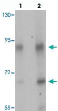 Anti-TGM5 Rabbit Polyclonal Antibody