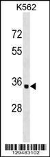 Anti-OR10AD1 Rabbit Polyclonal Antibody (HRP (Horseradish Peroxidase))