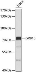 Anti-GRB10 Antibody (A11176)