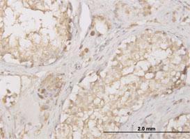 Anti-CTSD Mouse Monoclonal Antibody [clone: 3F12-1B9]