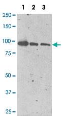 Anti-FOLH1 Mouse Monoclonal Antibody [clone: GCP-04]