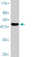 Anti-FHL5 Mouse Monoclonal Antibody [clone: 1G12-D2]