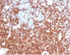 Immunohistochemical analysis of formalin-fixed, paraffin-embedded human colon using Anti-CD43 Antibody [rSPN/6563] at 2 µg/ml in PBS for 30  minutes at room temperature