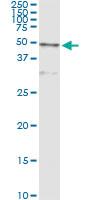 Anti-CTSD Mouse Monoclonal Antibody [clone: 3F12-1B9]