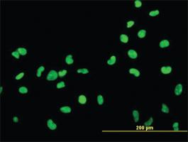 Anti-HMGB2 Mouse Monoclonal Antibody [clone: 3E5]