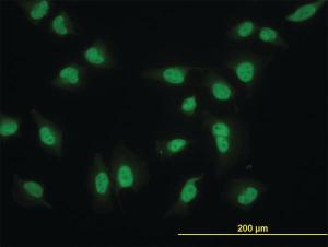 Anti-MED17 Mouse Monoclonal Antibody [clone: 1B5]