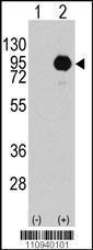 Anti-BRAF Rabbit Polyclonal Antibody (FITC (Fluorescein))