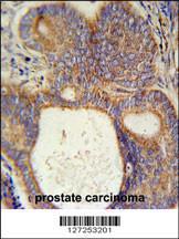 Anti-LYSMD1 Rabbit Polyclonal Antibody (FITC (Fluorescein Isothiocyanate))