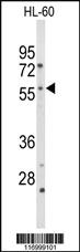 Anti-CYP2C19 Rabbit Polyclonal Antibody