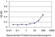 Anti-CTSD Mouse Monoclonal Antibody [clone: 3F12-1B9]