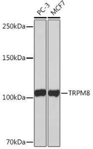 Western blot analysis of extracts of various cell lines, using Anti-TRPM8 Antibody [ARC0947] (A305914) at 1:1,000 dilution