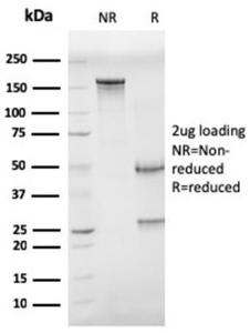 SDS-PAGE analysis of Anti-CD68 Antibody [CD68/G2] under non-reduced and reduced conditions; showing intact IgG and intact heavy and light chains, respectively SDS-PAGE analysis confirms the integrity and purity of the antibody