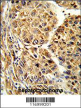 Anti-CYP2C19 Rabbit Polyclonal Antibody