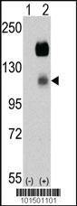 Anti-CCK4 (PTK7) Rabbit Polyclonal Antibody