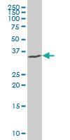 Anti-MYOD Mouse Polyclonal Antibody