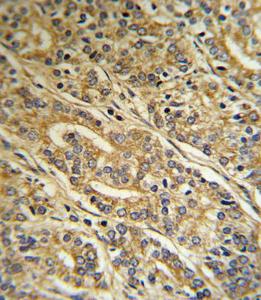 Anti-ACOT8 Rabbit Polyclonal Antibody (AP (Alkaline Phosphatase))